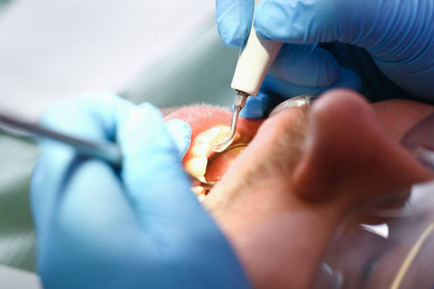 Best Mobile Emergency Dentist in Coeburn, VA