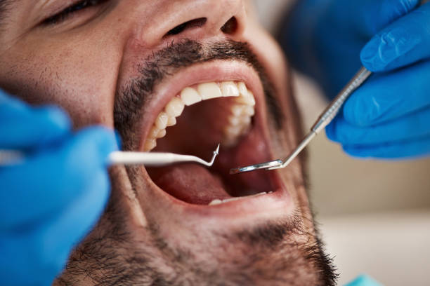 Best Emergency Dental Extractions in Coeburn, VA